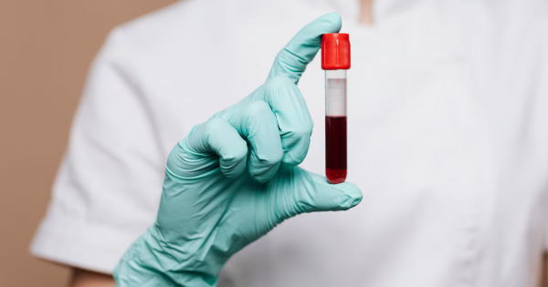 Japón inicia ensayos con sangre artificial: un giro histórico en la medicina moderna Japón inicia ensayos con sangre artificial: un giro histórico en la medicina moderna