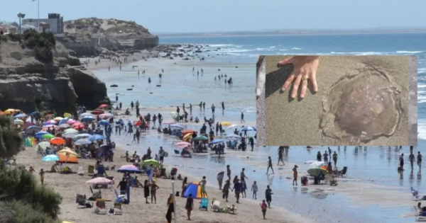 Más de 70 personas sufrieron picaduras de aguas vivas en Las Grutas